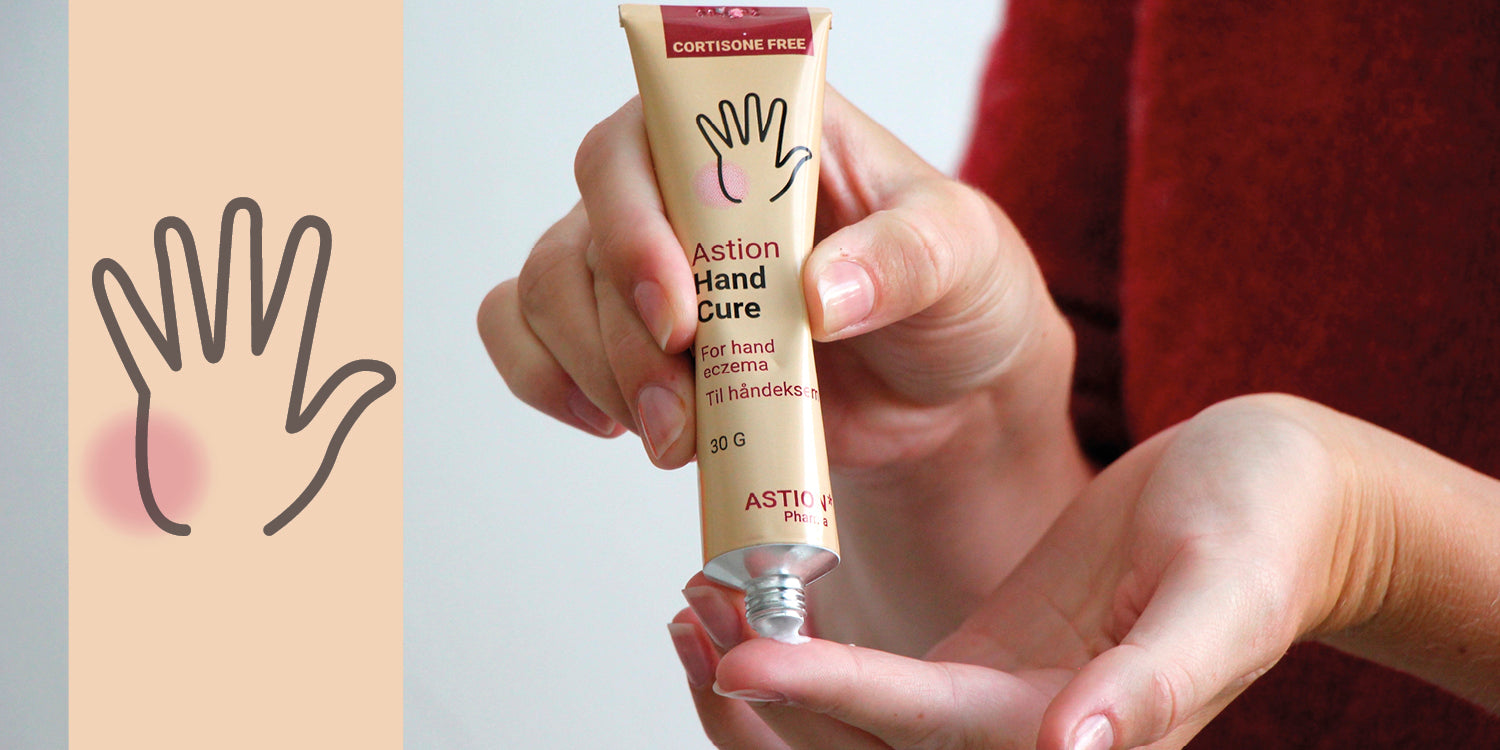 Produkter för torra händer och vård vid handeksem